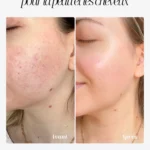 Comparaison avant-après de la peau du visage illustrant les bienfaits beauté de la soie de mûrier et la réduction des frottements nocturnes.